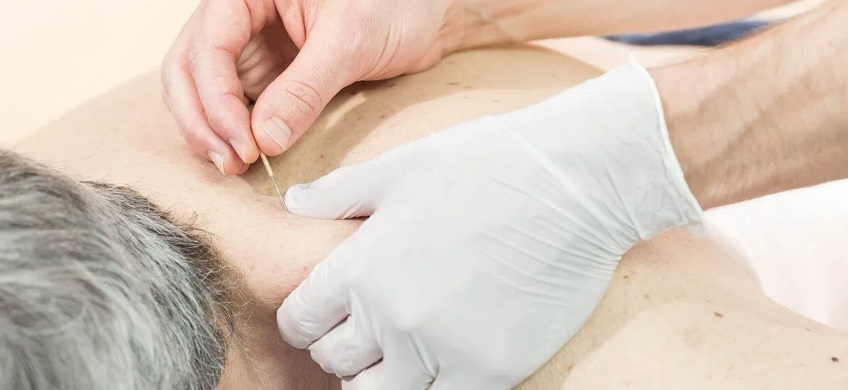 Traditionelle Chinesische Medizin