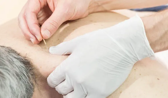 Traditionelle Chinesische Medizin