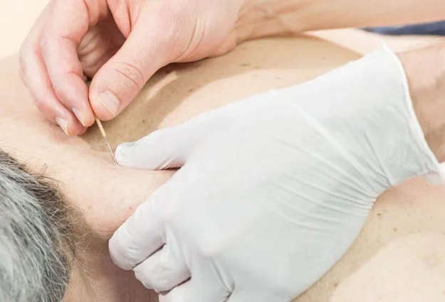 Traditionelle Chinesische Medizin