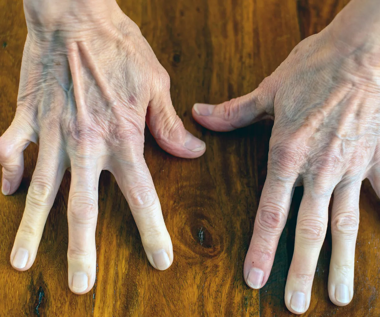 Zwei Hände mit sichtbaren Adern und Falten liegen auf einer Holzoberfläche, die Finger sind gespreizt. Die Nägel sind kurz und unlackiert.