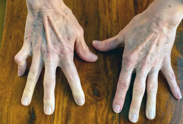 Zwei Hände mit sichtbaren Adern und Falten liegen auf einer Holzoberfläche, die Finger sind gespreizt. Die Nägel sind kurz und unlackiert.