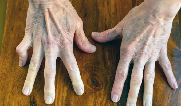 Zwei Hände mit sichtbaren Adern und Falten liegen auf einer Holzoberfläche, die Finger sind gespreizt. Die Nägel sind kurz und unlackiert.