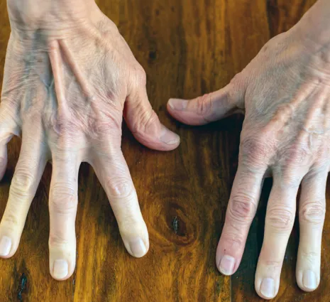 Zwei Hände mit sichtbaren Adern und Falten liegen auf einer Holzoberfläche, die Finger sind gespreizt. Die Nägel sind kurz und unlackiert.