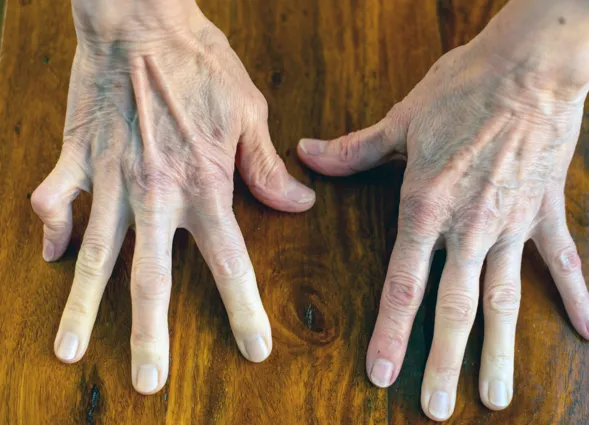 Zwei Hände mit sichtbaren Adern und Falten liegen auf einer Holzoberfläche, die Finger sind gespreizt. Die Nägel sind kurz und unlackiert.